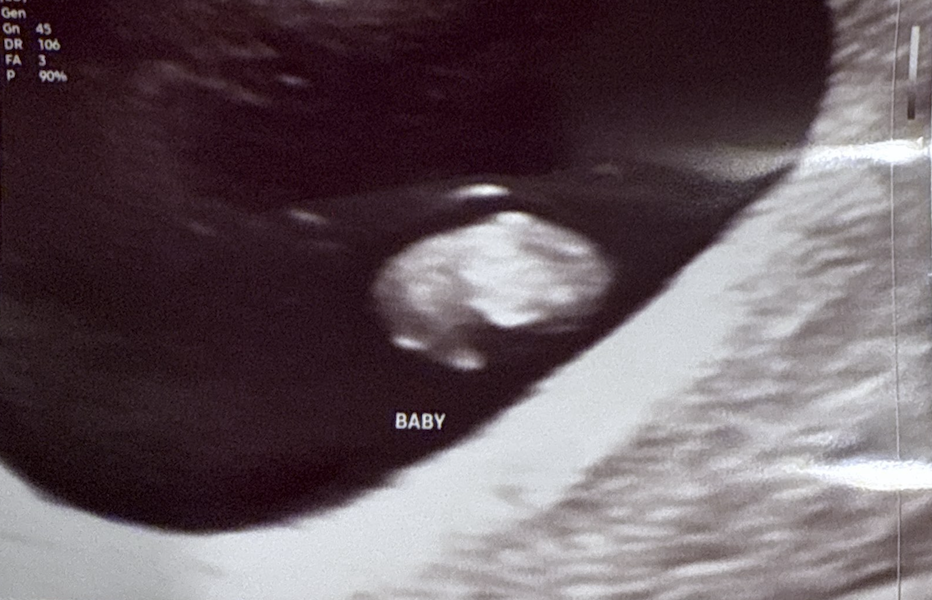 baby